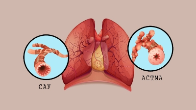 قولقا دەمىكپەسى (استما)