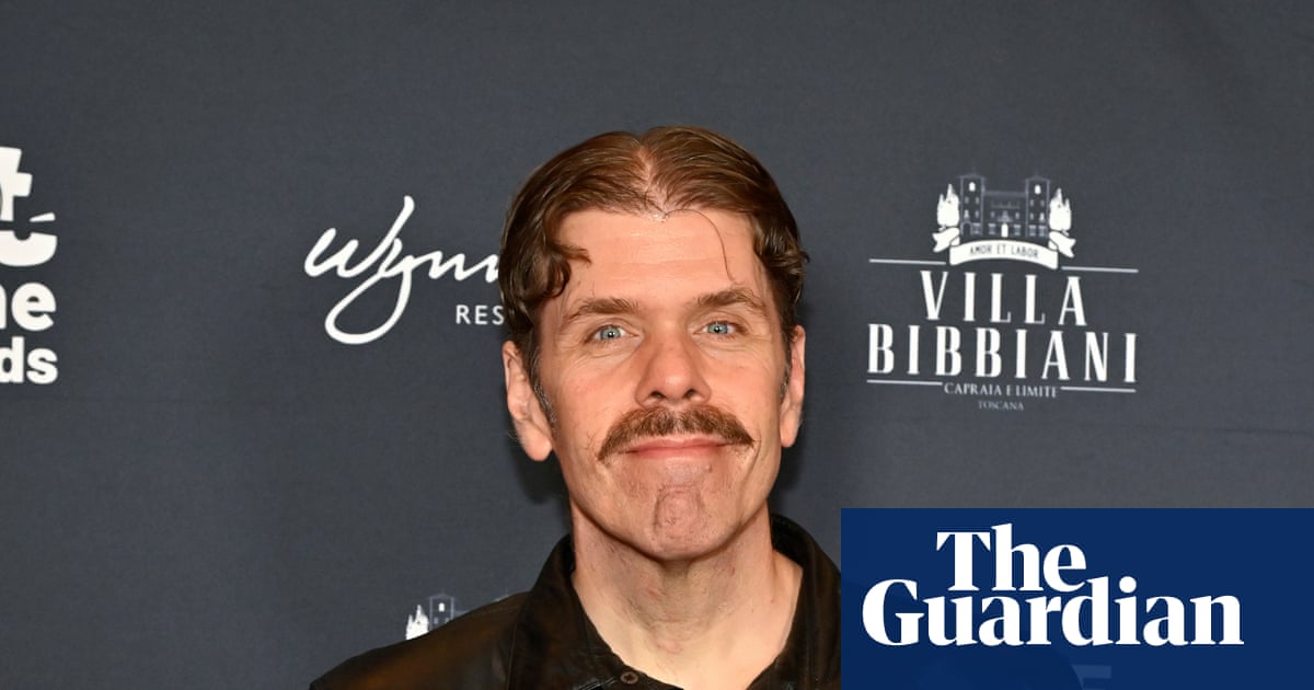 Perez Hilton TikTok-та өзін-өзі жарақаттауды көрсетіп, ауруханаға түсті