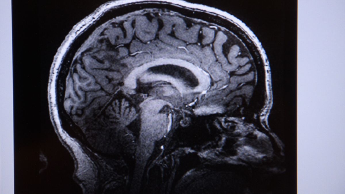Neuroscientists Prove Brain Can Think Logically Without Language