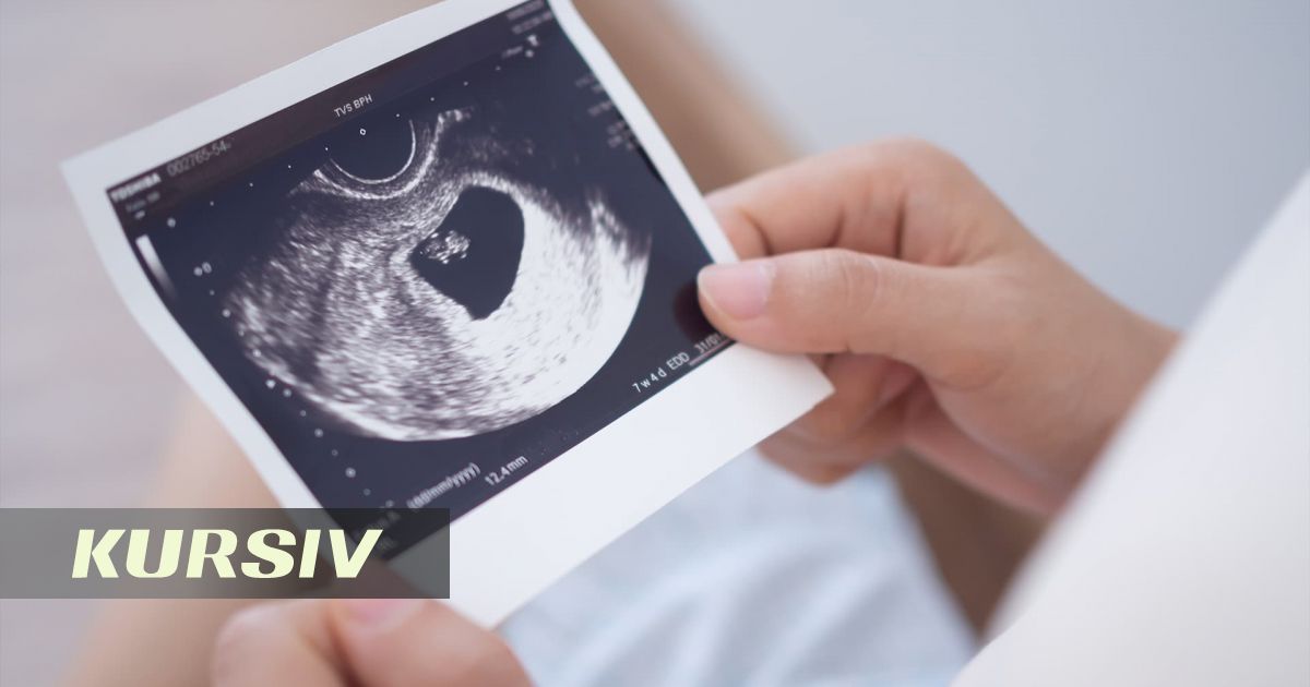 Kazakhstan to Introduce New Rules for Storing Medical Images from August 23