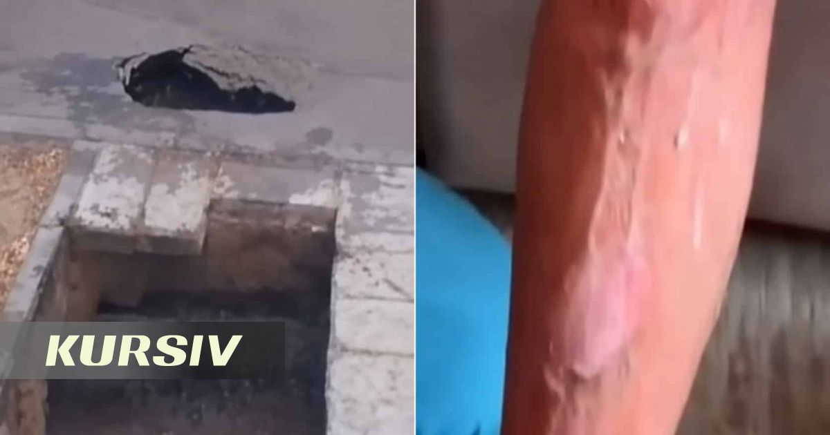 Pavlodar man injured in boiling water pit receives compensation