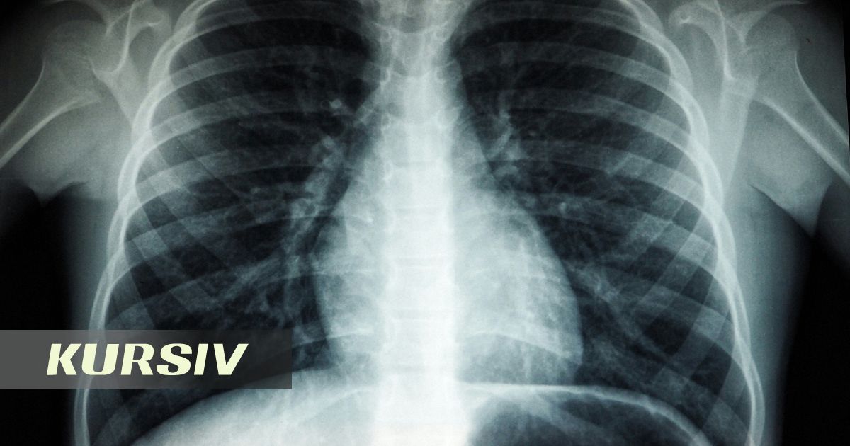 Chinese Doctors Find Multiple Needles in 35-Year-Old Man's Body