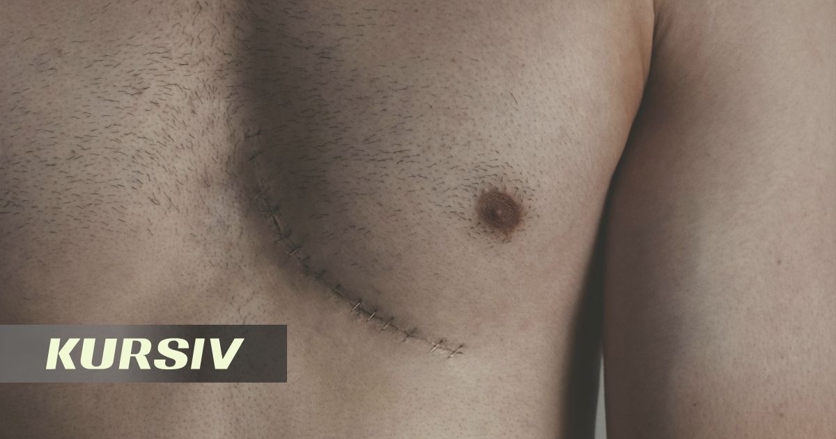 About 20 Men Being Treated for Breast Cancer in Almaty