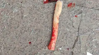 مۋجچينا س توپوروم ۋسترويل پەرەپولوح ۆ جيلوم كومپلەكسە استانى